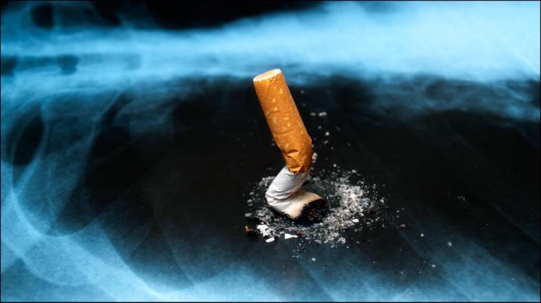 Akciğer kanserinin baş nedeni sigara.